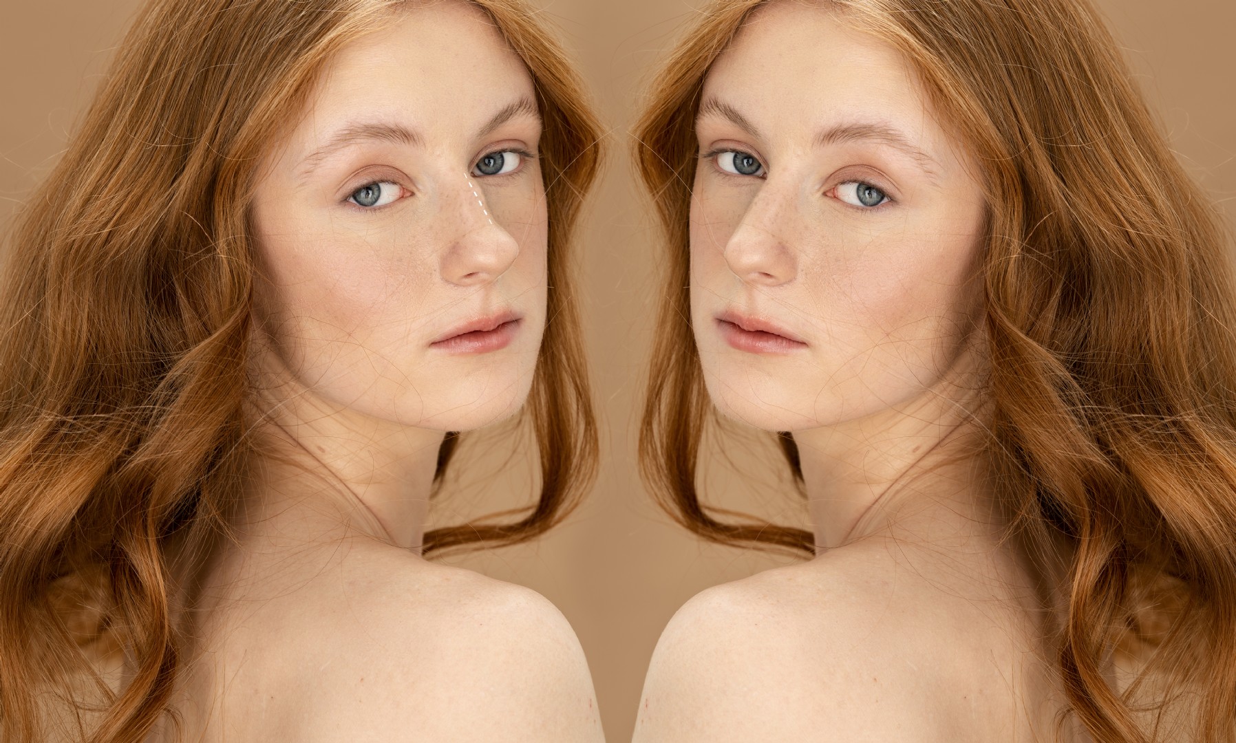 Revision Rhinoplasty Surgery